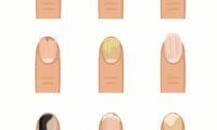 The Most Common Nail Signs